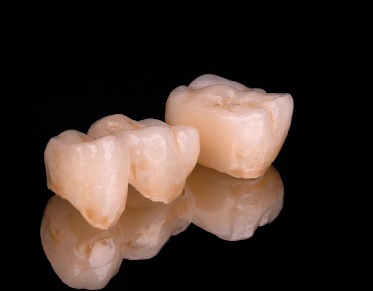 Foto 2 de Bradaschia.Lab | Laboratório de Prótese Dentária Digital e Híbrido em Goiânia