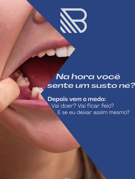 Foto 3 de Brandão Odontologia - Implante Dentário no Gama
