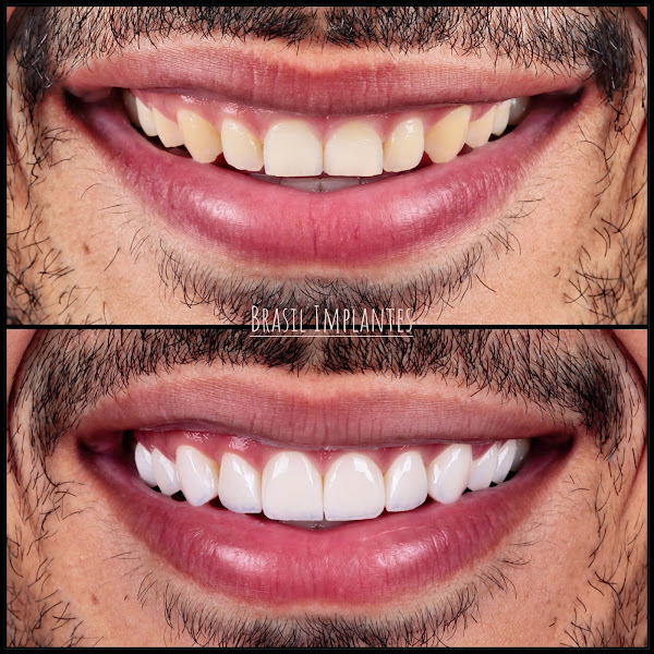 Foto 2 de Brasil Implantes - Odontologia e estética facial