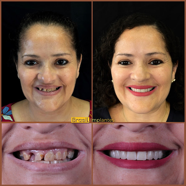 Foto 3 de Brasil Implantes - Odontologia e estética facial