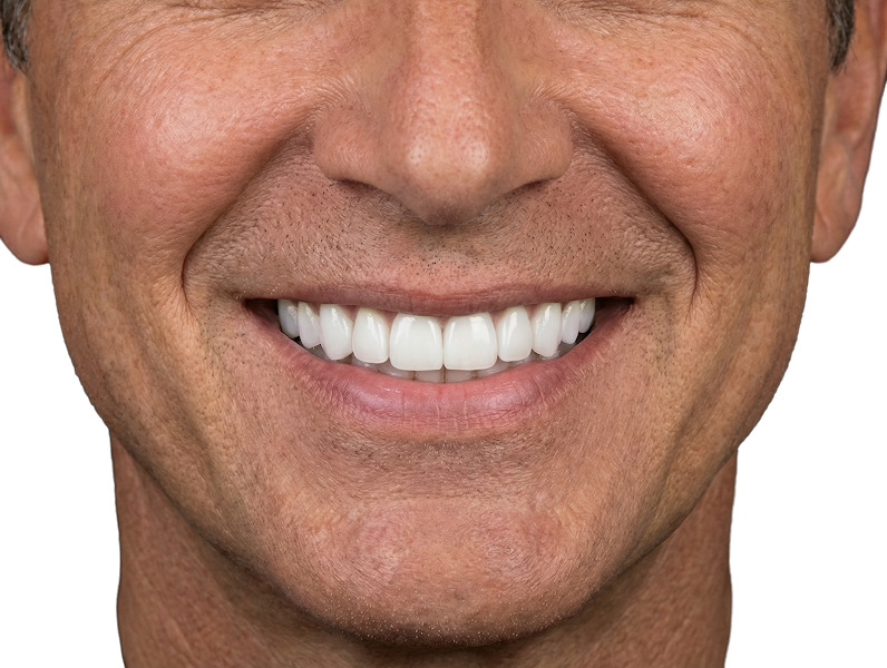 Foto 3 de Brasil Premium Implantes