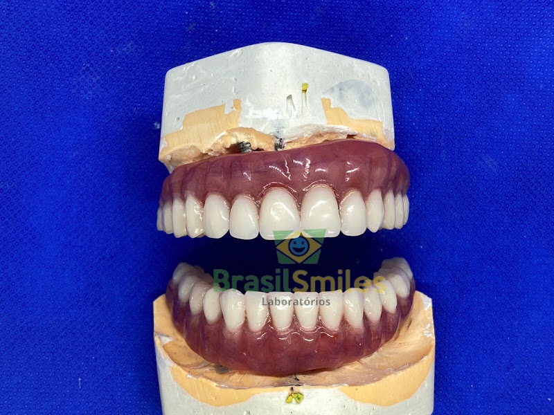 Foto 2 de Brasil Smiles - Laboratório