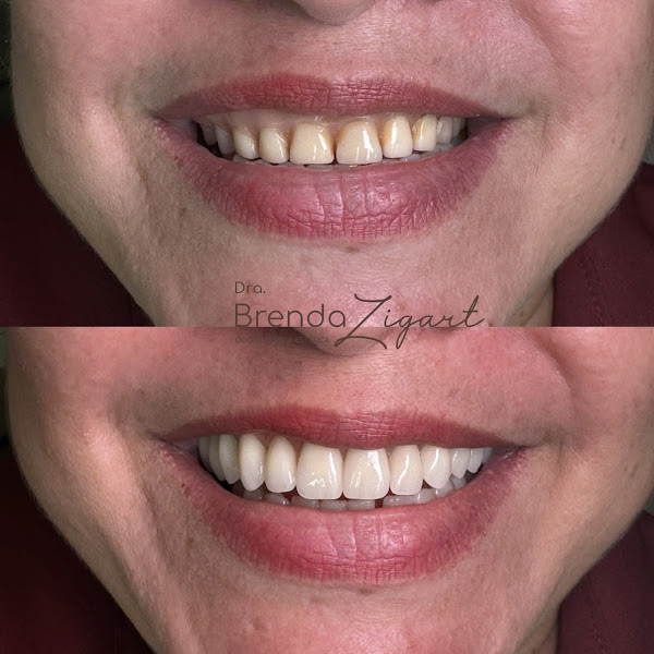 Foto 2 de Brenda Zigart Odontologia
