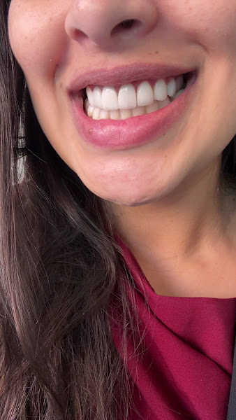 Foto 3 de Brilha Dentes