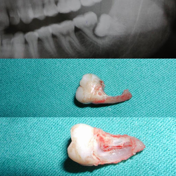 Foto 2 de Brilho Mais Odontologia