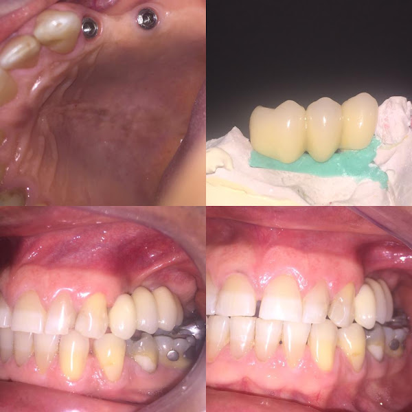 Foto 3 de Brilho Mais Odontologia