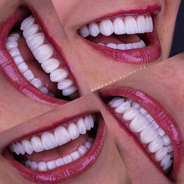 Foto 2 de Brilliance Odontologia Estética - Dra. Pamela Almeida