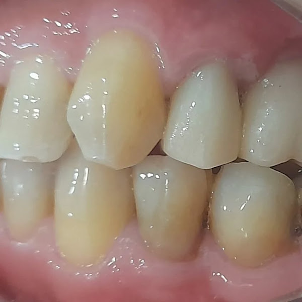 Foto 2 de Bruna Borges Odontologia