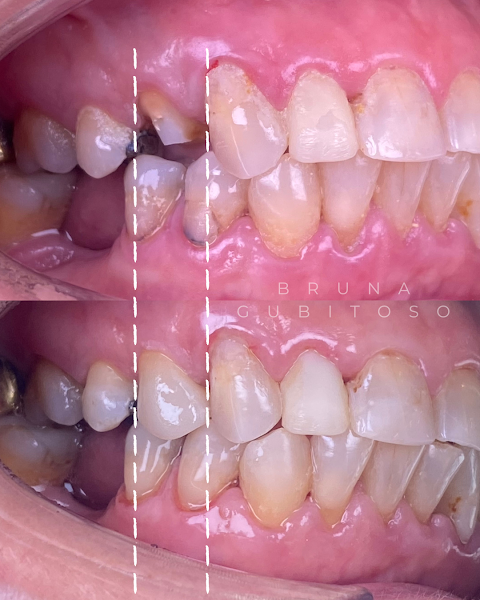 Foto 3 de Bruna Gubitoso Odontologia