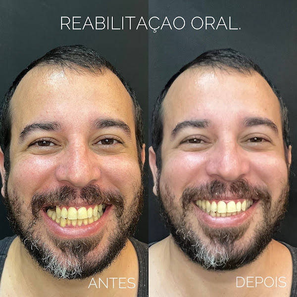 Foto 3 de Bruna Ribeiro Odontologia