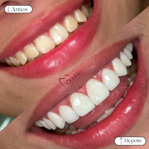 Foto 2 de Bruna Silveira - Odontologia Especializada