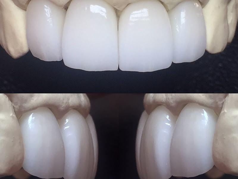 Foto de BRUNO NOVAIS - Prótese Dentária