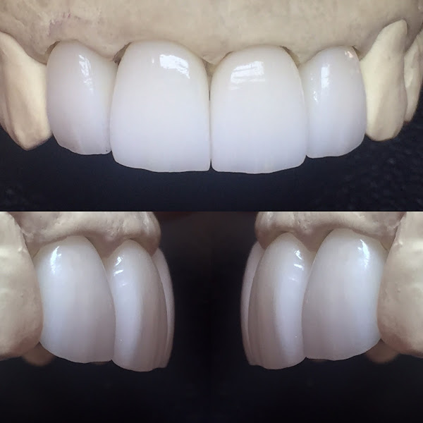 Foto 2 de BRUNO NOVAIS - Prótese Dentária