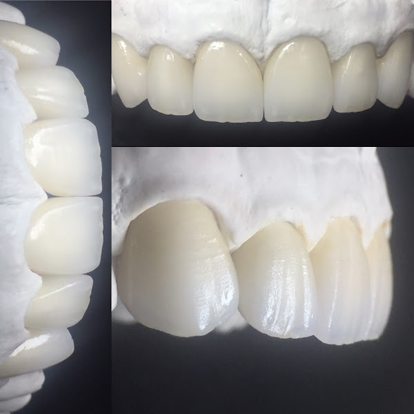 Foto 3 de BRUNO NOVAIS - Prótese Dentária