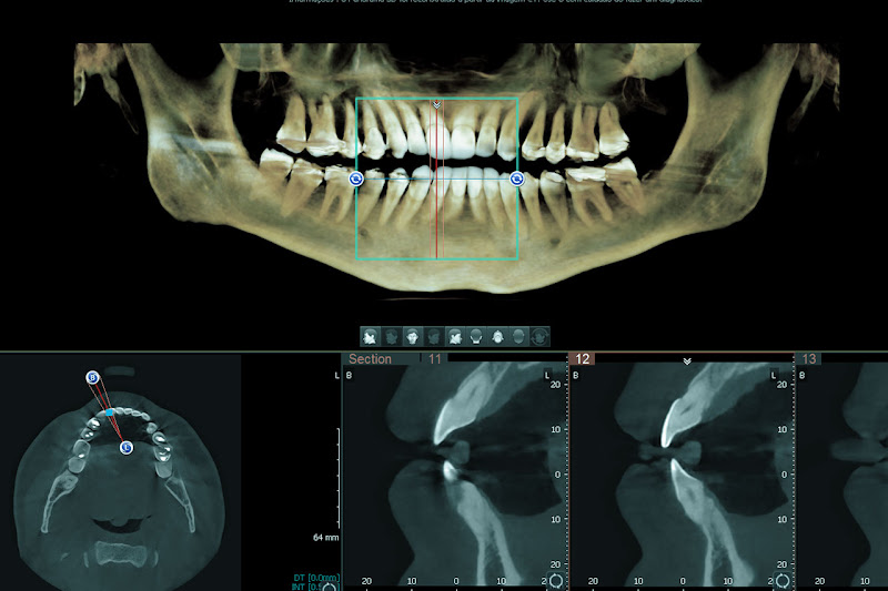 Foto 2 de Bucal X Radiologia Odontológica