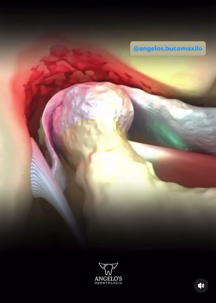 Foto 3 de Bucomaxilofacial Angelo’s Dentista de Emergência 24 horas Aberto Recreio Rj