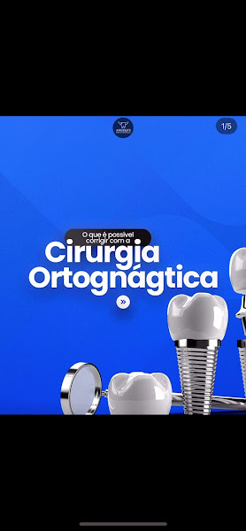 Foto 4 de Bucomaxilofacial Angelo’s Dentista de Emergência 24 horas Aberto Recreio Rj