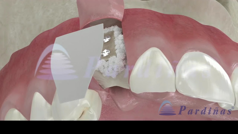 Foto 3 de BUCOMAXILOFACIAL CIRURGIÃO PORTO VELHO - RO - Dr. Láwrency Gorayeb - BUCAL FACE CLÍNICA DE CIRURGIA