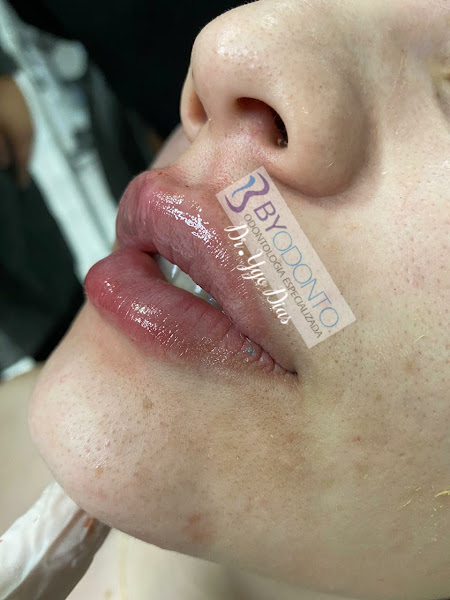 Foto 3 de BYODONTO CRATO