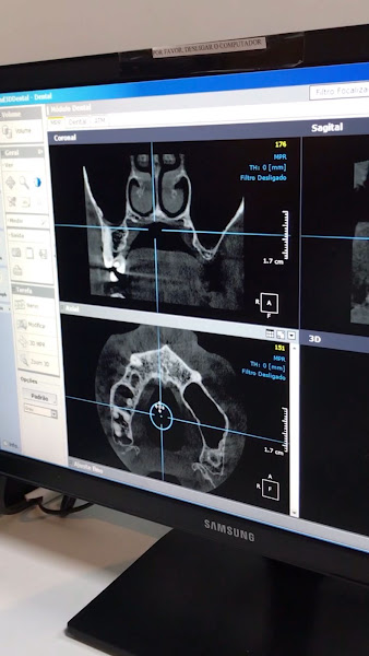 Foto 2 de C.I.R.O. Diagnóstico Odontológico por Imagem | Unidade Jaiara Anápolis | Radiologia Odontológica