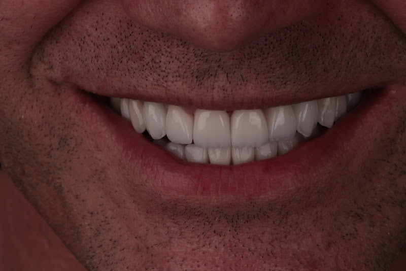 Foto 2 de C R odonto digital