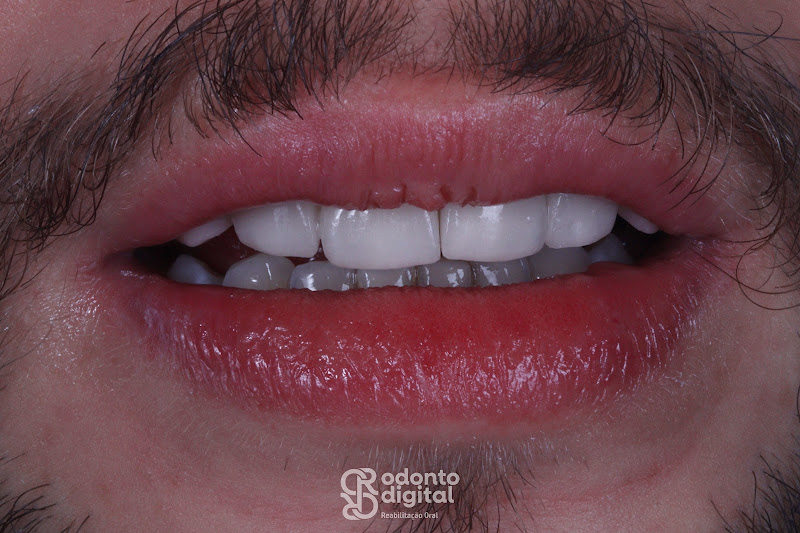 Foto 3 de C R odonto digital