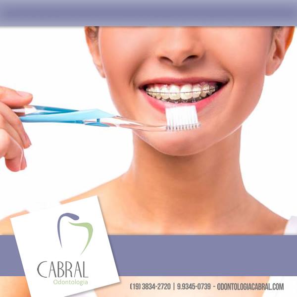 Foto 3 de Cabral Ortodontia