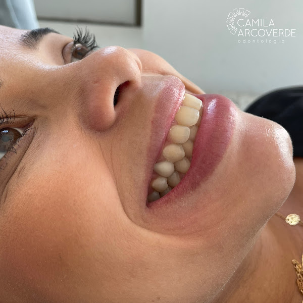 Foto 3 de Camila Arcoverde Odontologia