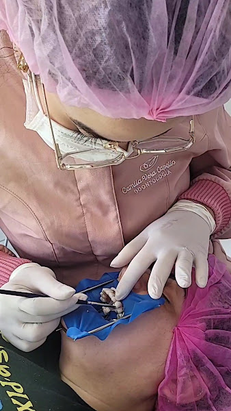 Foto 4 de Camila Vera Capello - Odontologia - Aparelho Invisível SouSmile