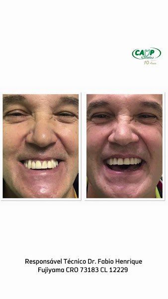 Foto 3 de Camp Dentes Campinas 1