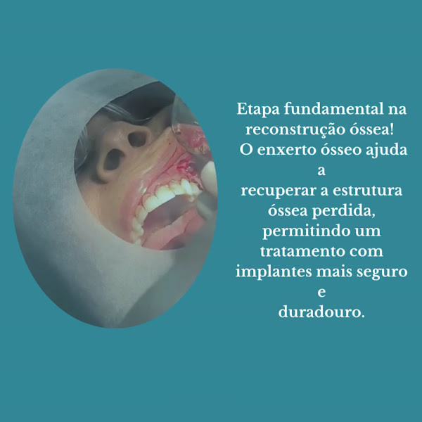 Foto 3 de Campos Reabilitação Oral - Dentista