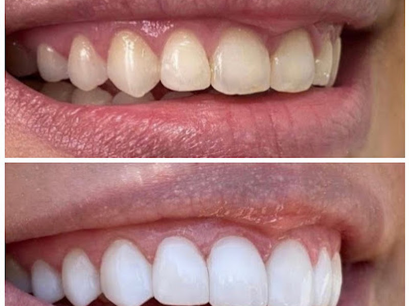 Foto 11 de Candeloro Dental Studio