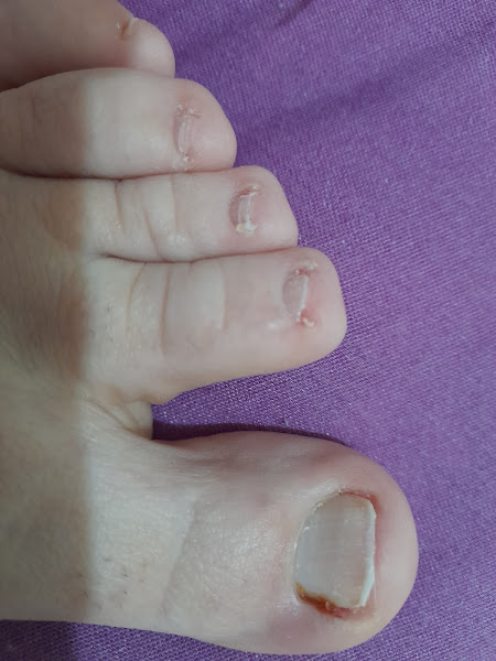 Foto 3 de Cantinho Da Podologia