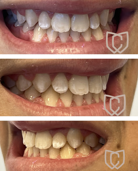 Foto 3 de Caputti Odontologia