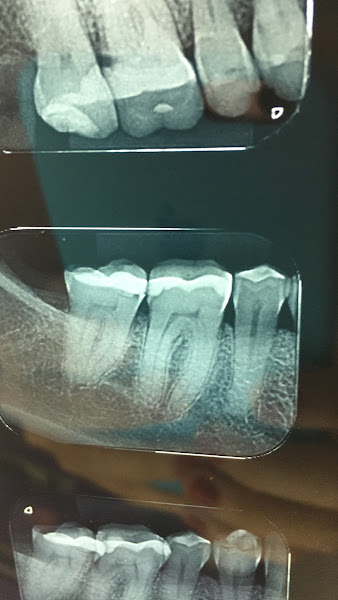 Foto 3 de Cárie Zero