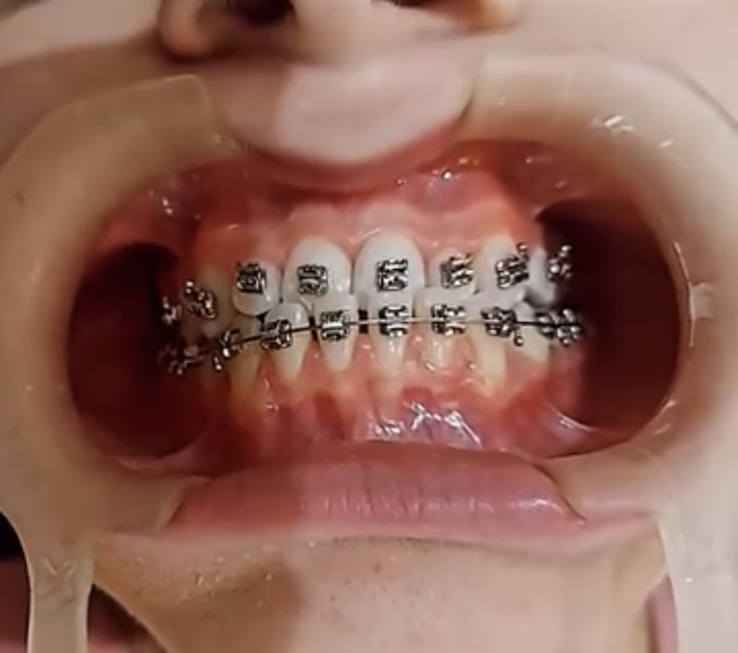 Foto 2 de Carla Carvalho (Urgências Odontológicas e Ortodontia)