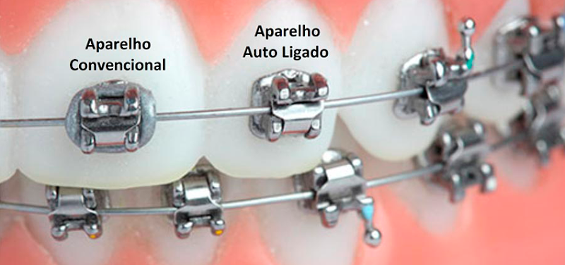 Foto 3 de Carla Carvalho (Urgências Odontológicas e Ortodontia)