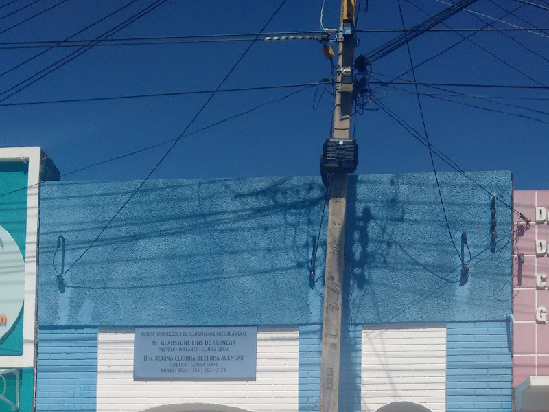 Foto 3 de Carlos Prótese