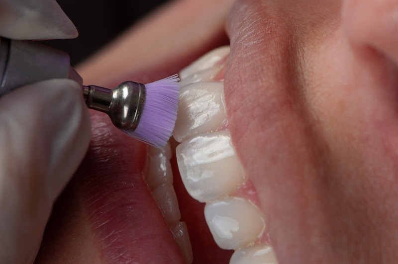 Foto 3 de Carol Pedrosa Smile Design