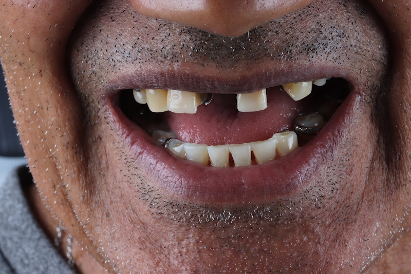 Foto 2 de Carolina Freire | Dentista Estética e Restauradora