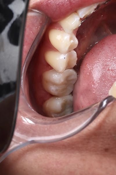 Foto 3 de Carolina Freire | Dentista Estética e Restauradora