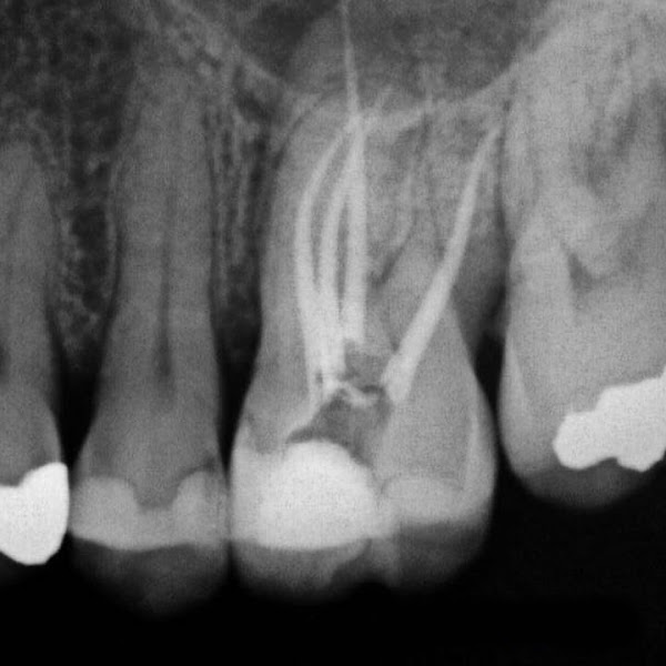 Foto 3 de Carvalho e Marino Odontologia Especializada