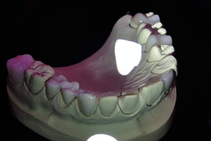 Foto 2 de Casa da Prótese