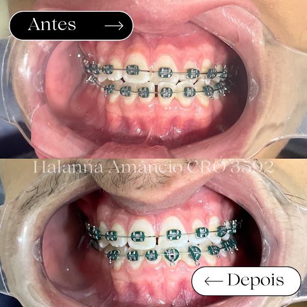 Foto 2 de Casa do Sorriso