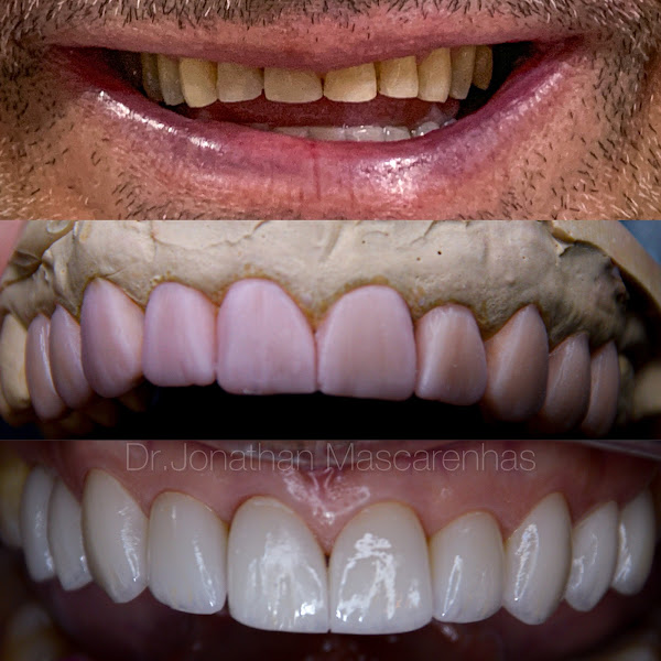 Foto 2 de Casal Dentista | Odontologia e Estética | Lipo de Papada em Rio Verde-GO