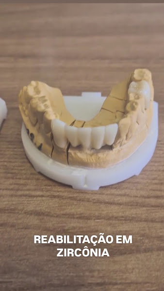 Foto 3 de Cassani Dental Studio - Implante | Lente de contato | Dentista Campinas