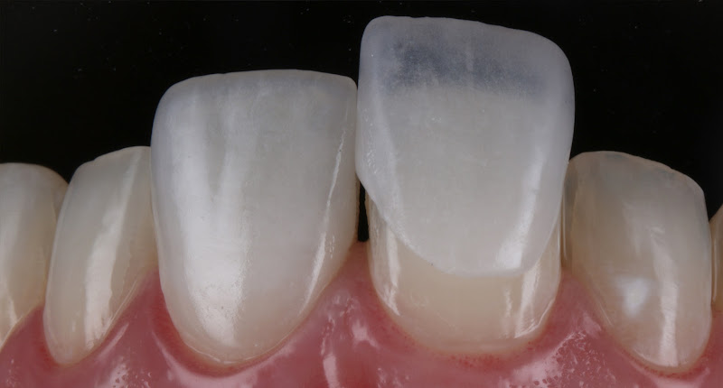 Foto 3 de Cássio Gaeski Odontologia Estética