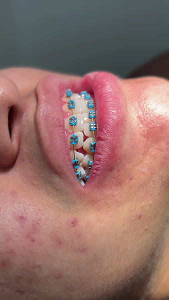 Foto 3 de Castro Neres Odontologia Especializada