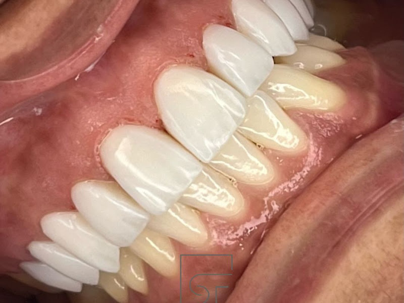 Foto 8 de Casulo Clínica Odontológica Implantes e Ortodontia - Implante e Aparelho dentário no Grajaú