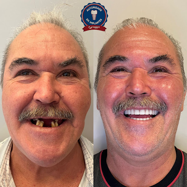 Foto 2 de Catarinense Implantes Blumenau